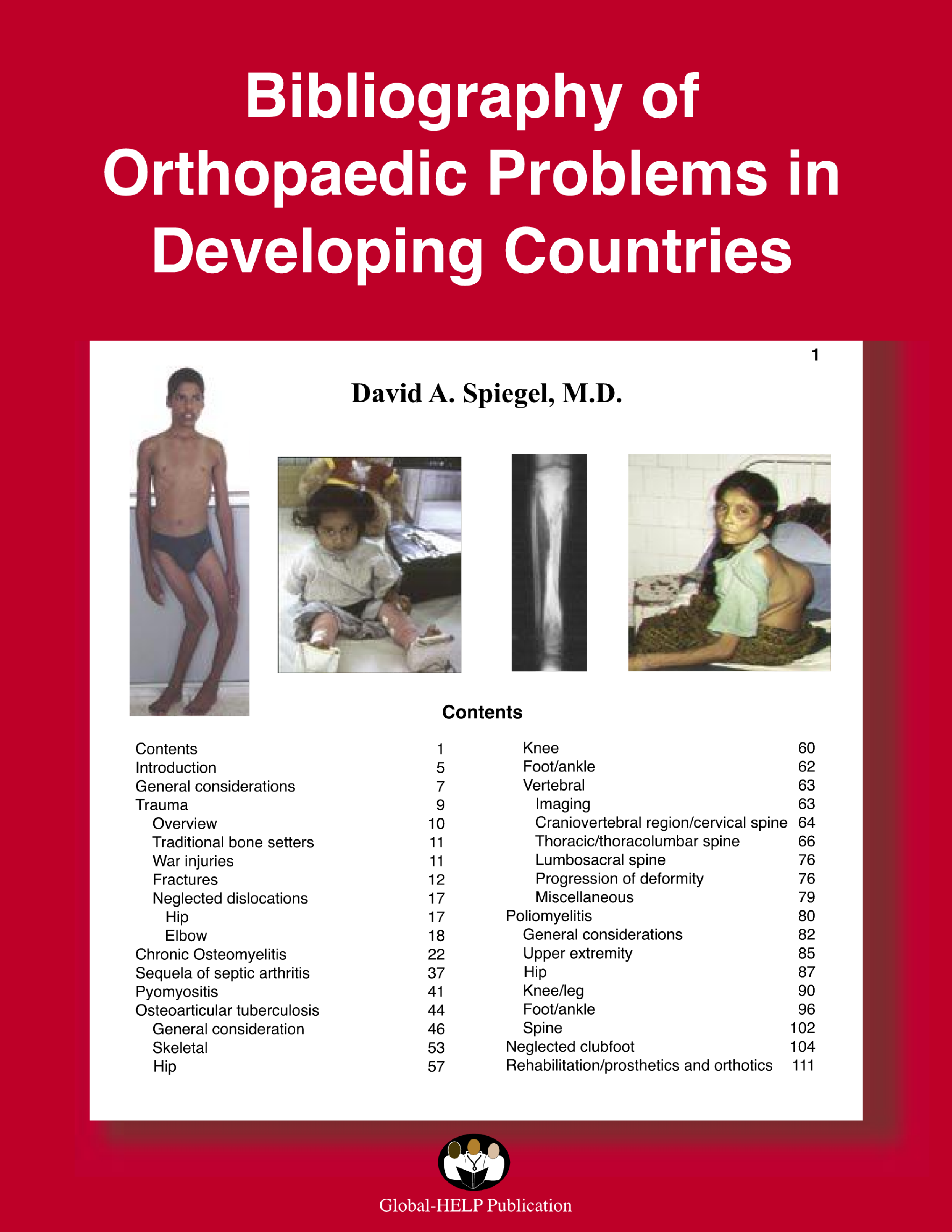 Bibliography Of Orthopaedic Problems In Developing Countries - Page 1