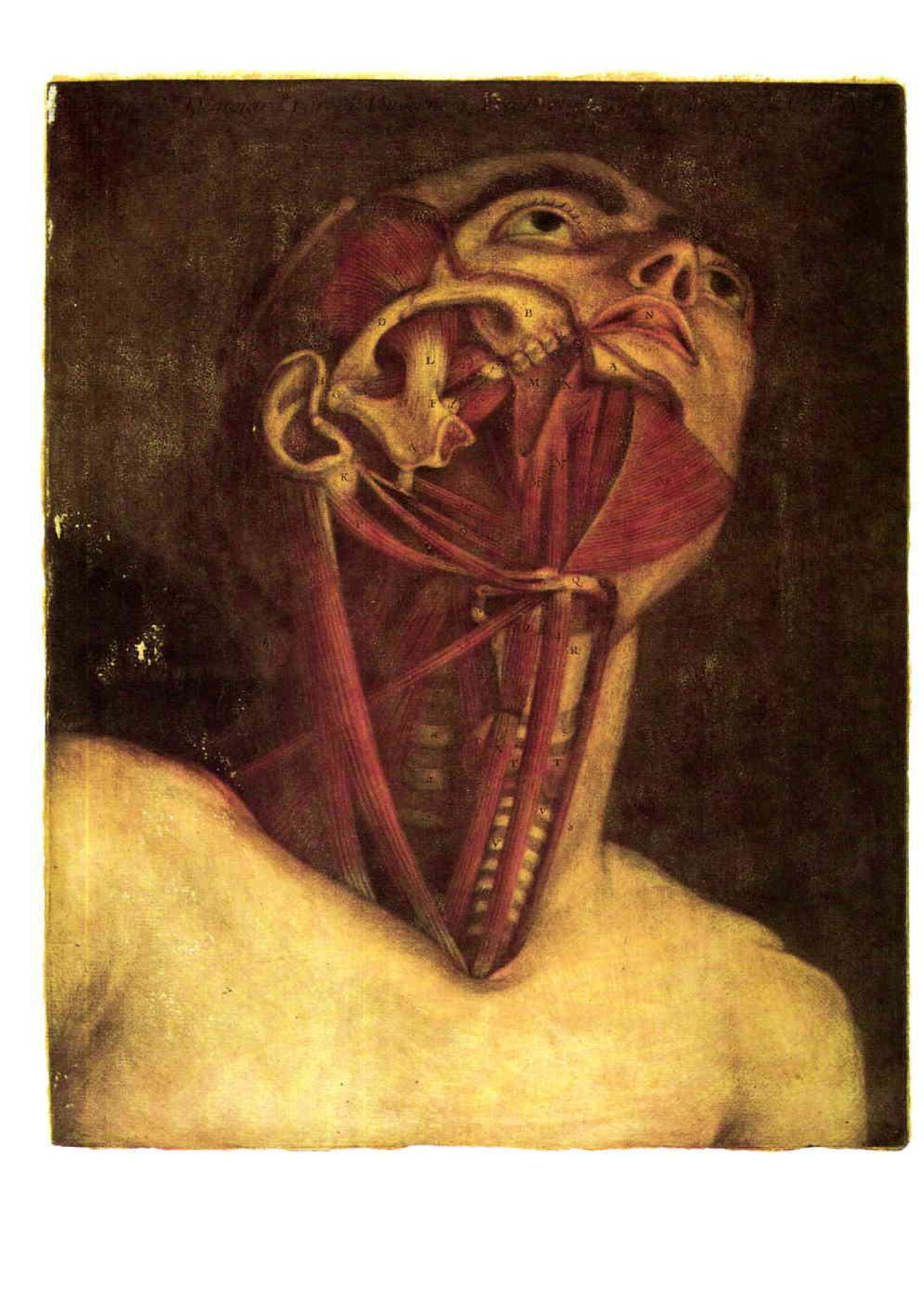 McCraw & Arnold\'s Atlas Of Muscle And Musculocutaneous Flaps - Page 4