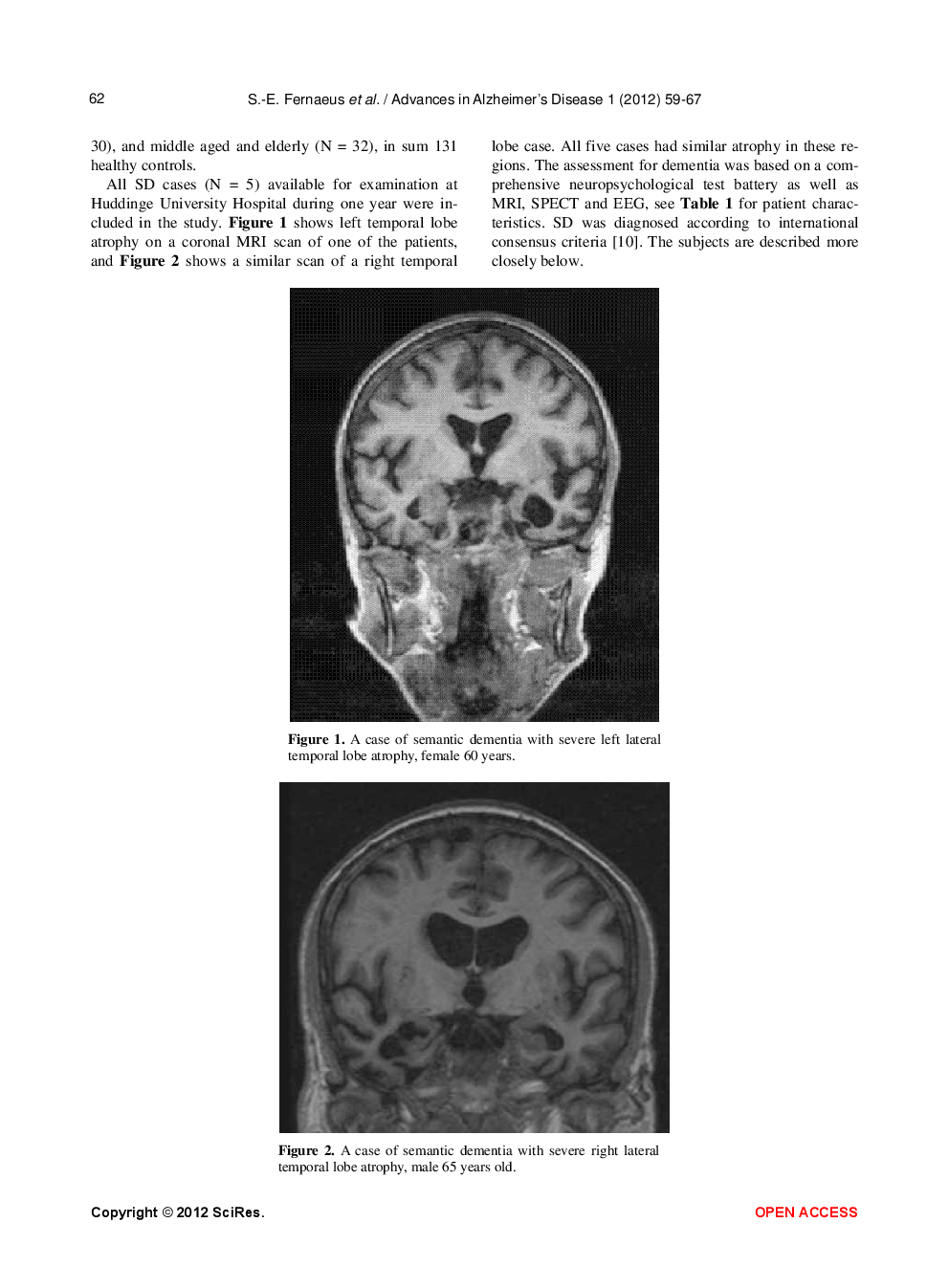 Paradoxical Prosopagnosia In Semantic Dementia - Page 5