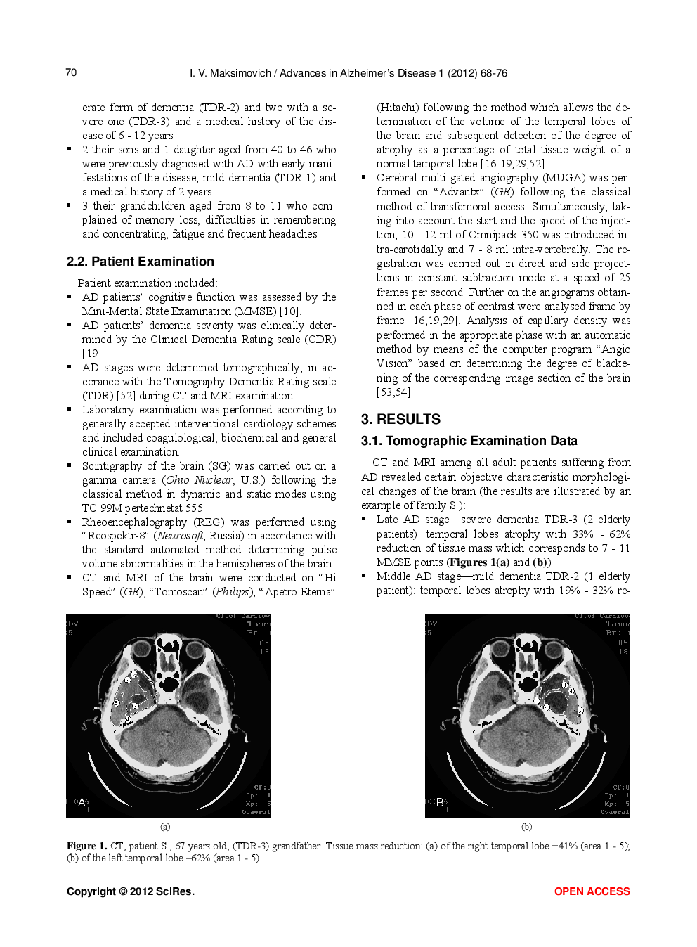 Certain New Aspects Of Etiology And Pathogenesis Of Alzheimer’s Disease - Page 4