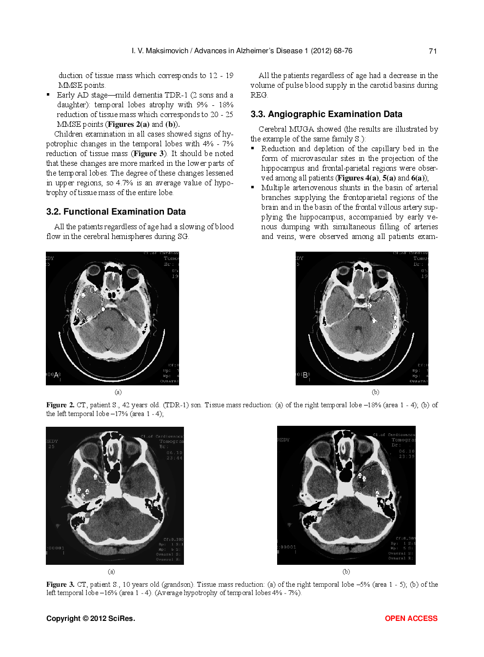 Certain New Aspects Of Etiology And Pathogenesis Of Alzheimer’s Disease - Page 5
