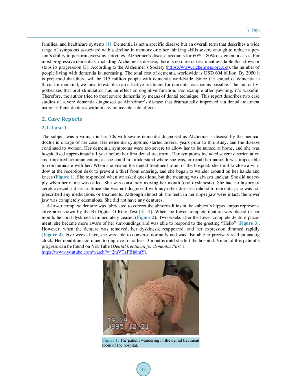 Two Cases Of Severe Dementia Showing Dramatic Improvement After Denture Placement - Page 3