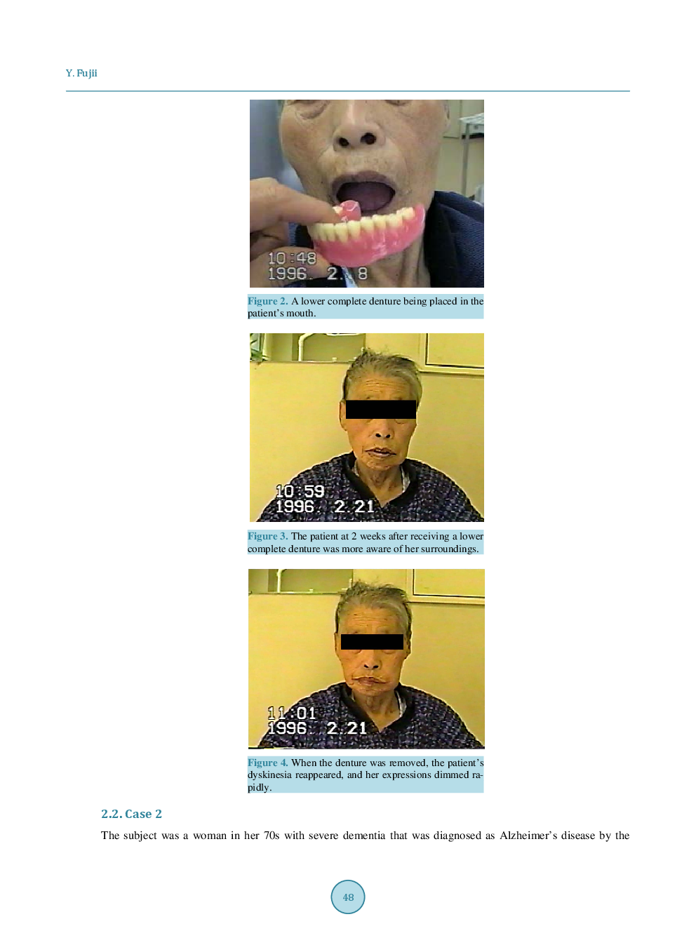 Two Cases Of Severe Dementia Showing Dramatic Improvement After Denture Placement - Page 4