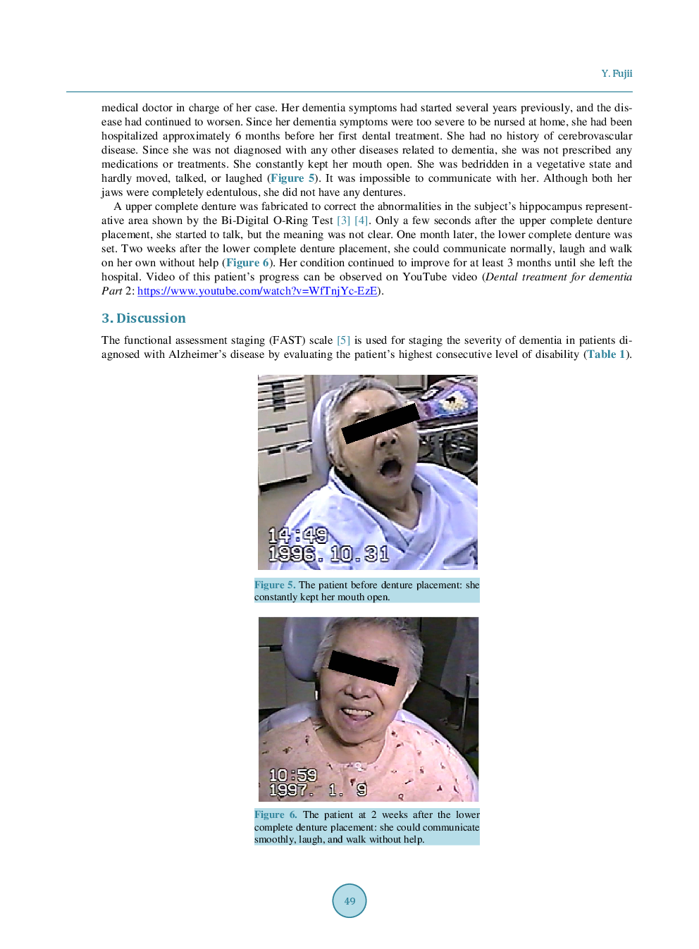 Two Cases Of Severe Dementia Showing Dramatic Improvement After Denture Placement - Page 5