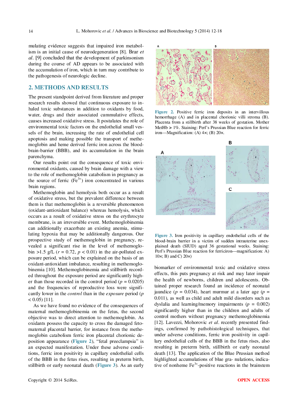 Methemoglobinemia—A Biomarker And A Link To Ferric Iron Accumulation In Alzheimer’s Disease - Page 4