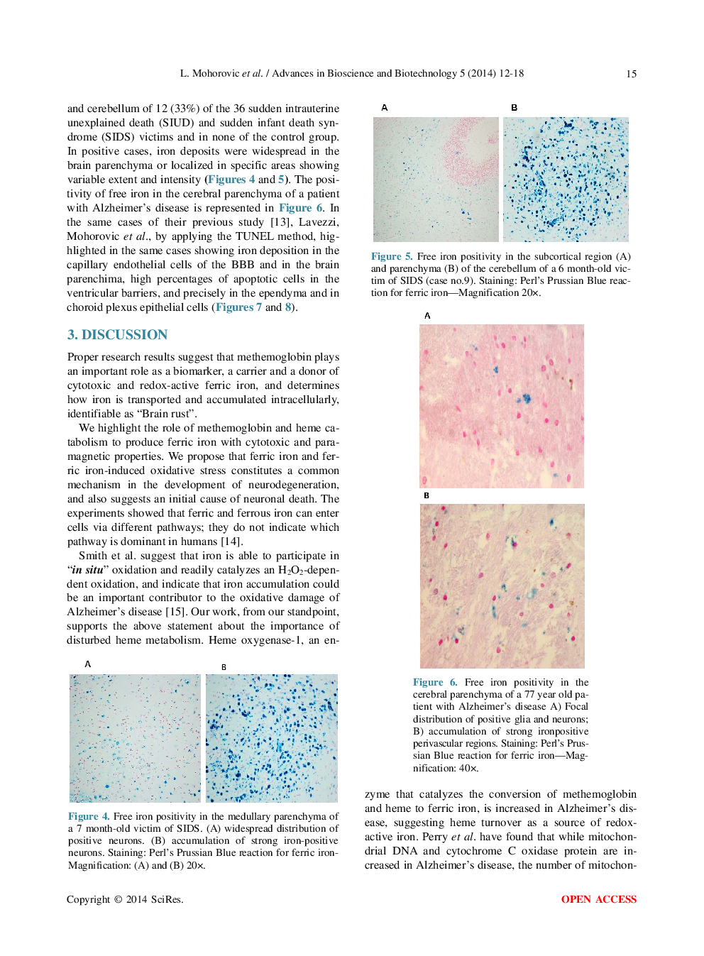 Methemoglobinemia—A Biomarker And A Link To Ferric Iron Accumulation In Alzheimer’s Disease - Page 5