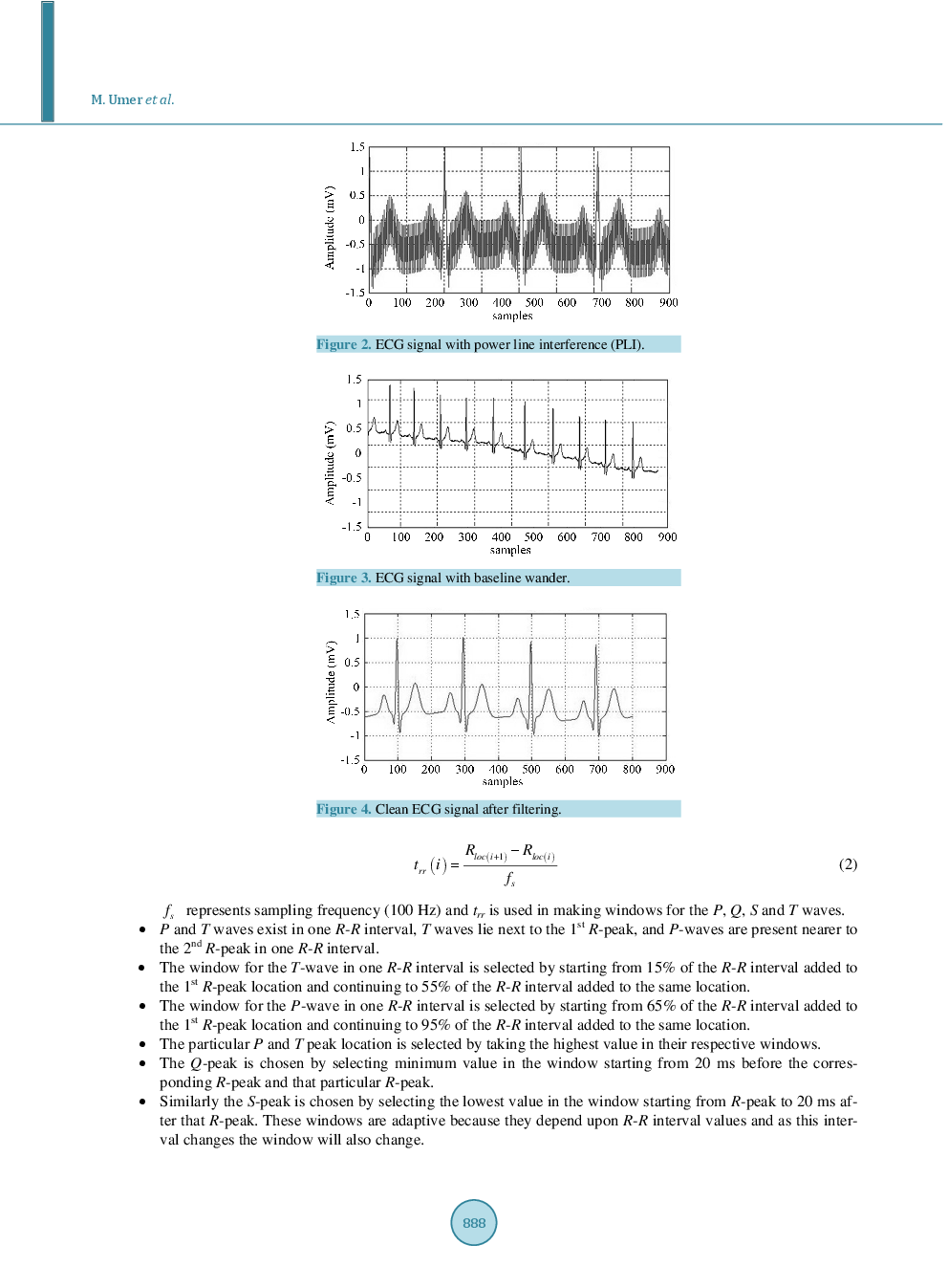 Electrocardiogram Feature Extraction And Pattern Recognition Using A Novel Windowing Algorithm - Page 4