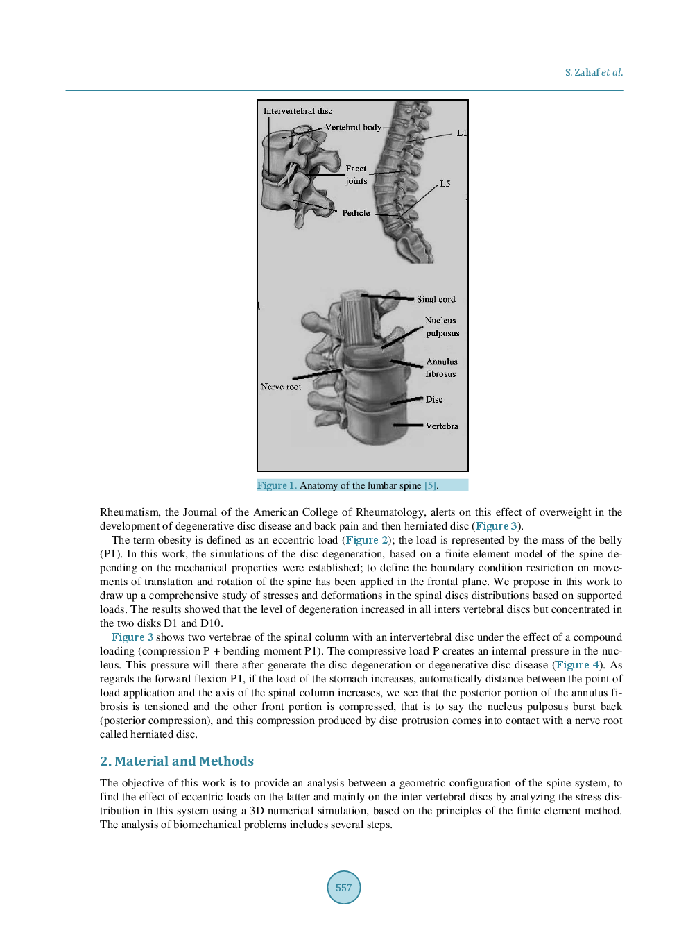 Obesity Effect On The Spine - Page 3