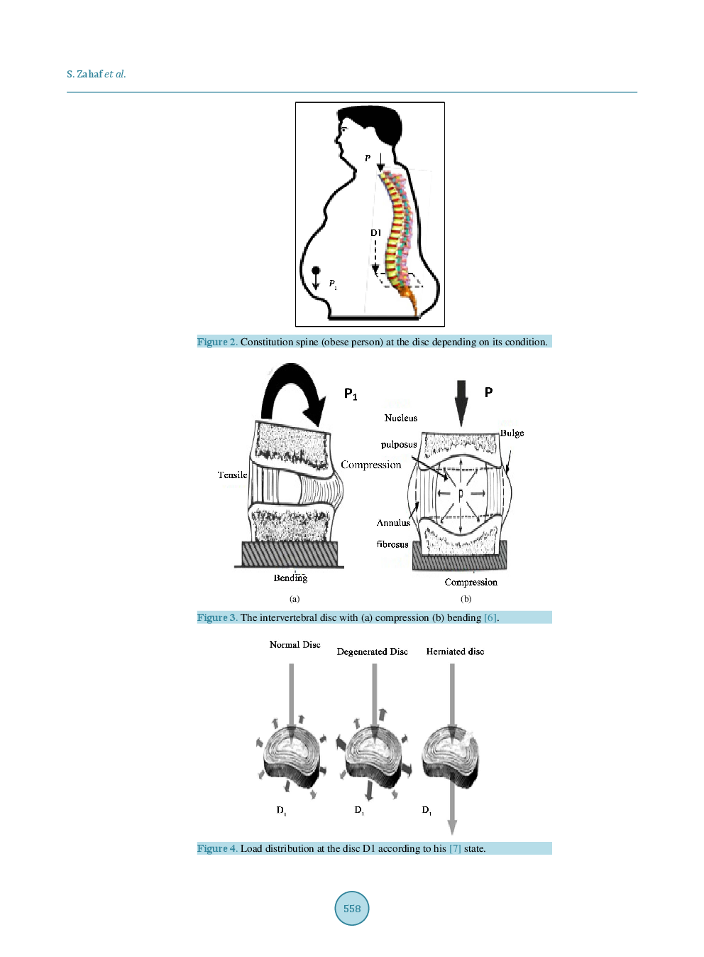 Obesity Effect On The Spine - Page 4