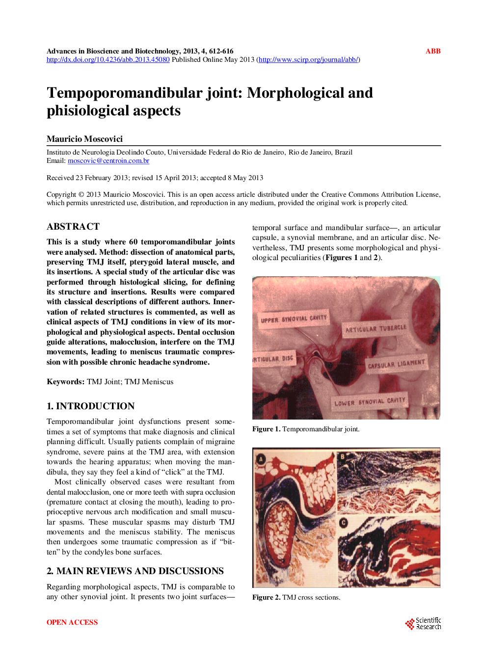 Tempoporomandibular Joint: Morphological And Phisiological Aspects - Page 2