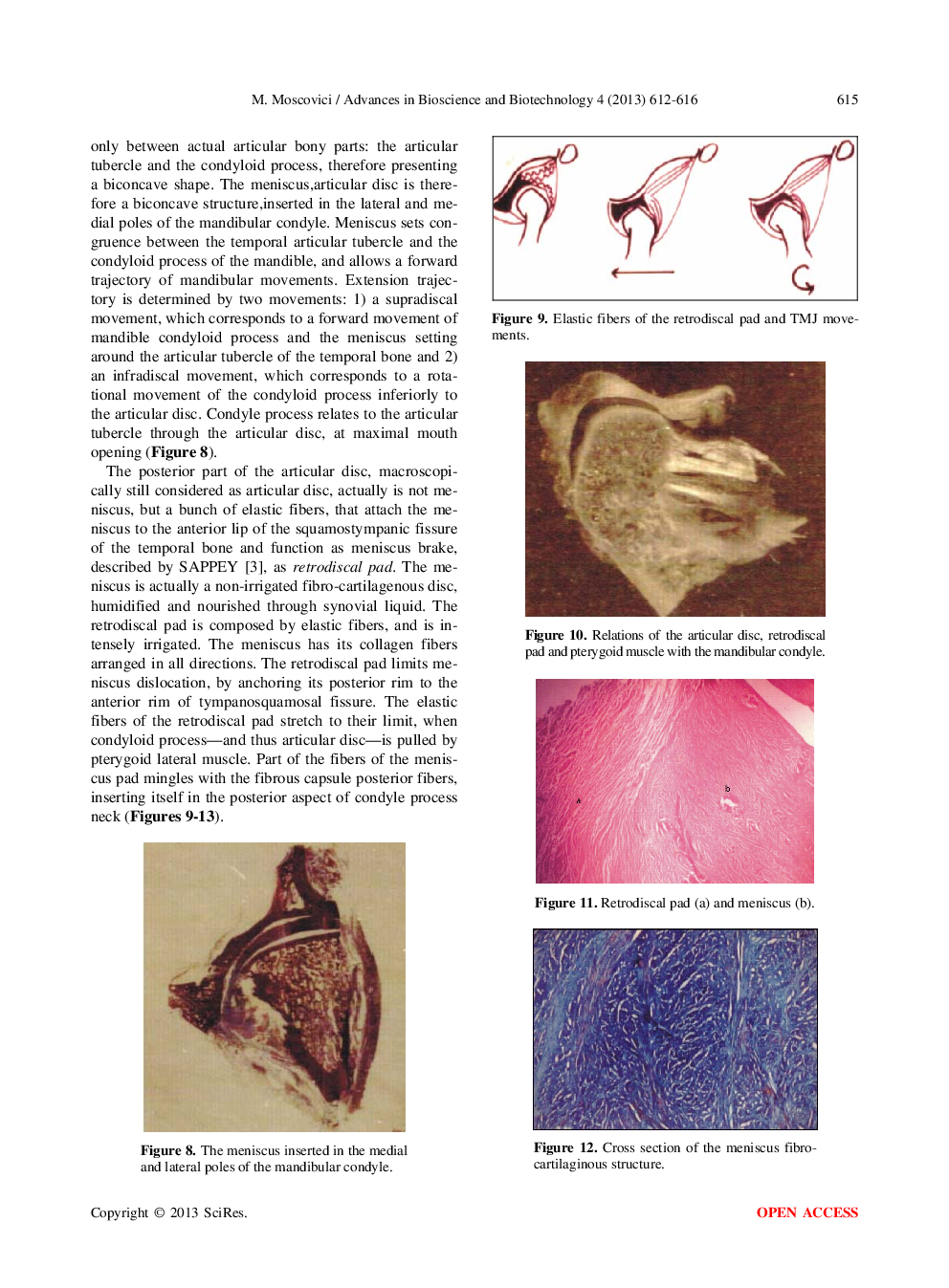Tempoporomandibular Joint: Morphological And Phisiological Aspects - Page 5