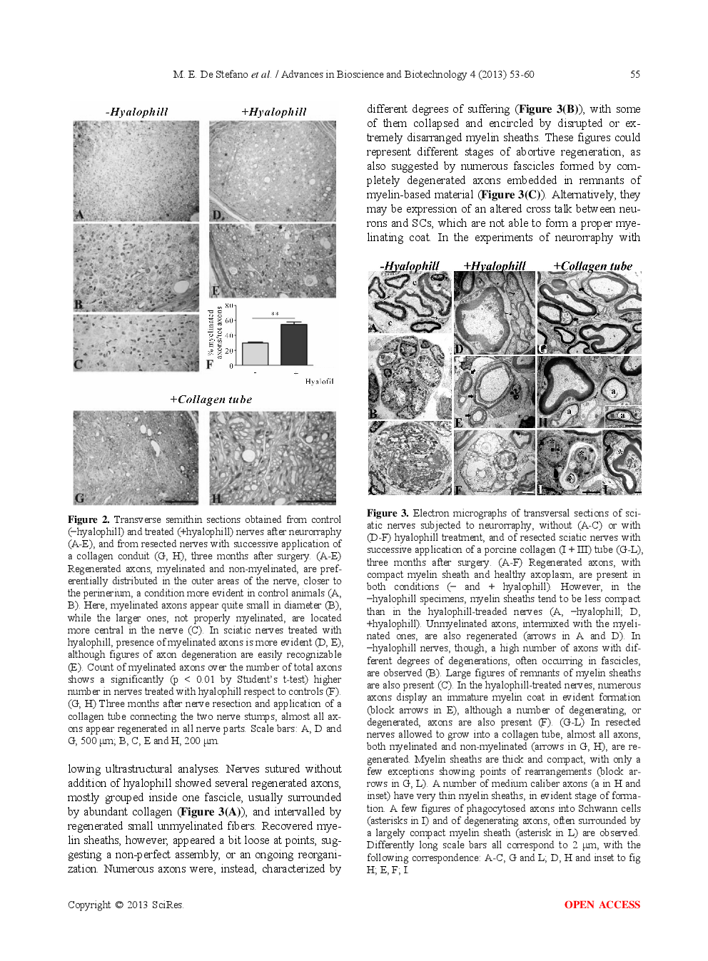 Therapeutic Approaches Enhancing Peripheral Nerve Regeneration - Page 4