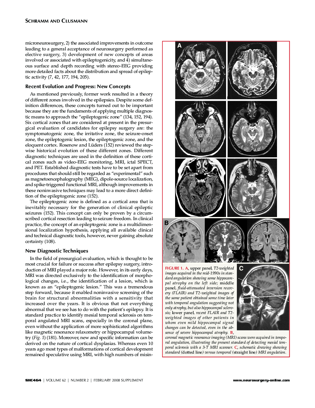Surgery of The Human Cerebrum Part-II - Page 5