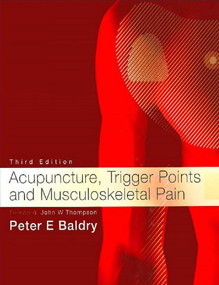 Acupuncture Trigger Points and Musculoskeletal Pain  - Page 1