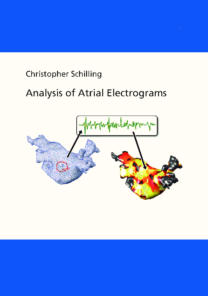 Analysis Of Atrial Electrograms - Page 1