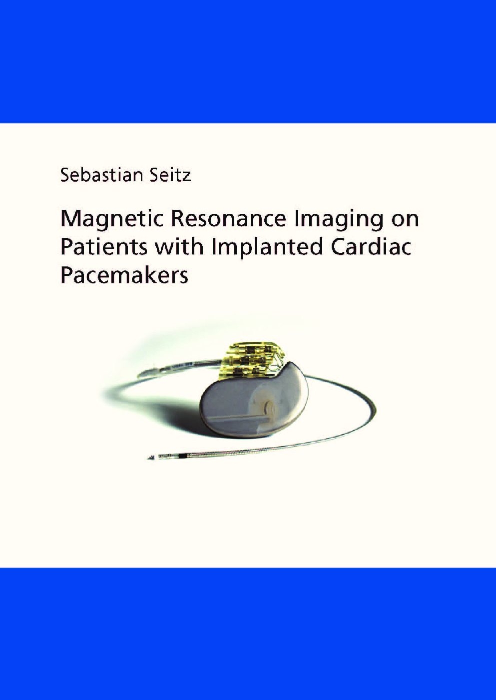Magnetic Resonance Imaging On Patients With Implanted Cardiac Pacemakers - Page 1