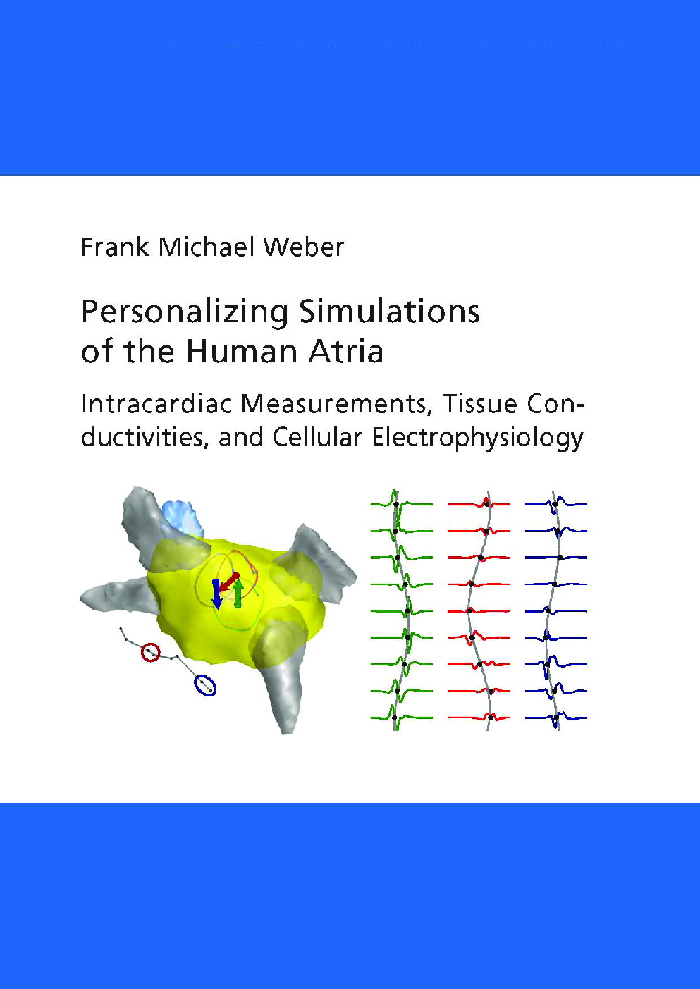 Personalizing Simulations Of The Human Atria - Page 1